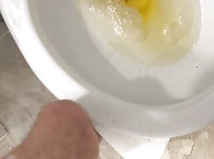 Guy With Cerebral Palsy has Massive Load of Pee for You 